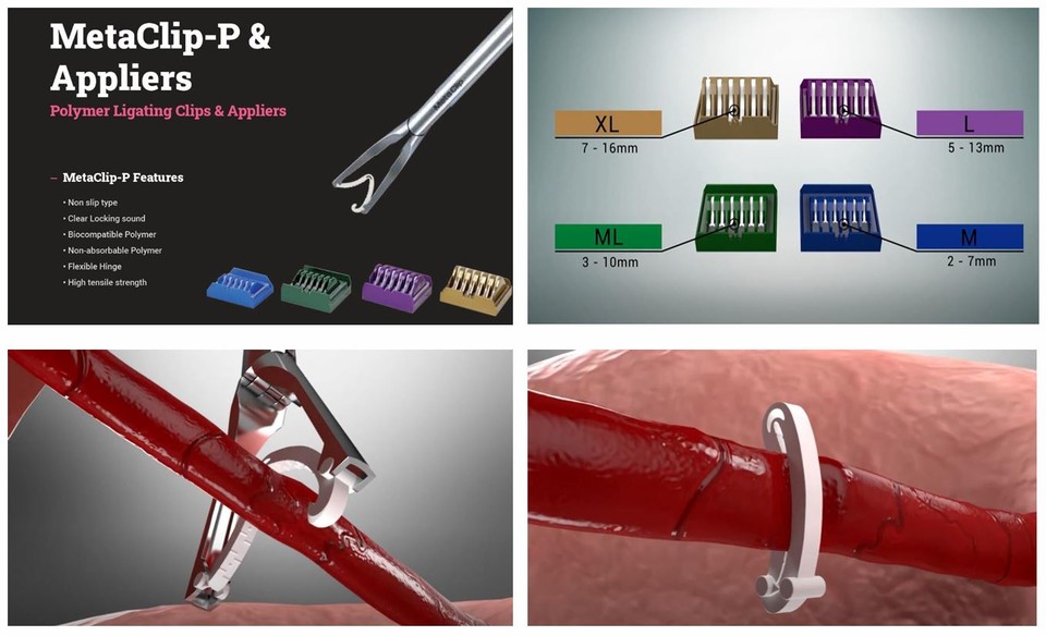 ▲ ㈜메타바이오메드가 세계 최초로 ‘CE MDR’ 인증을 받은 ‘Meta Clip-P’ 제품.